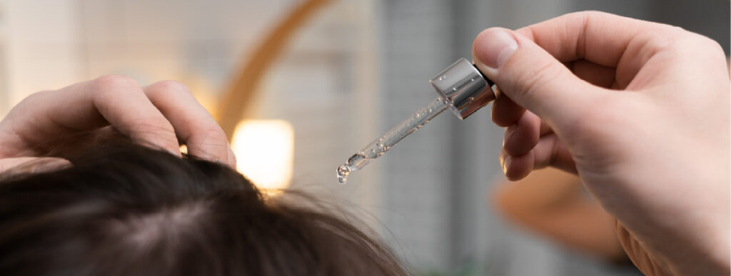 minoxidil, todo lo que necesitas saber